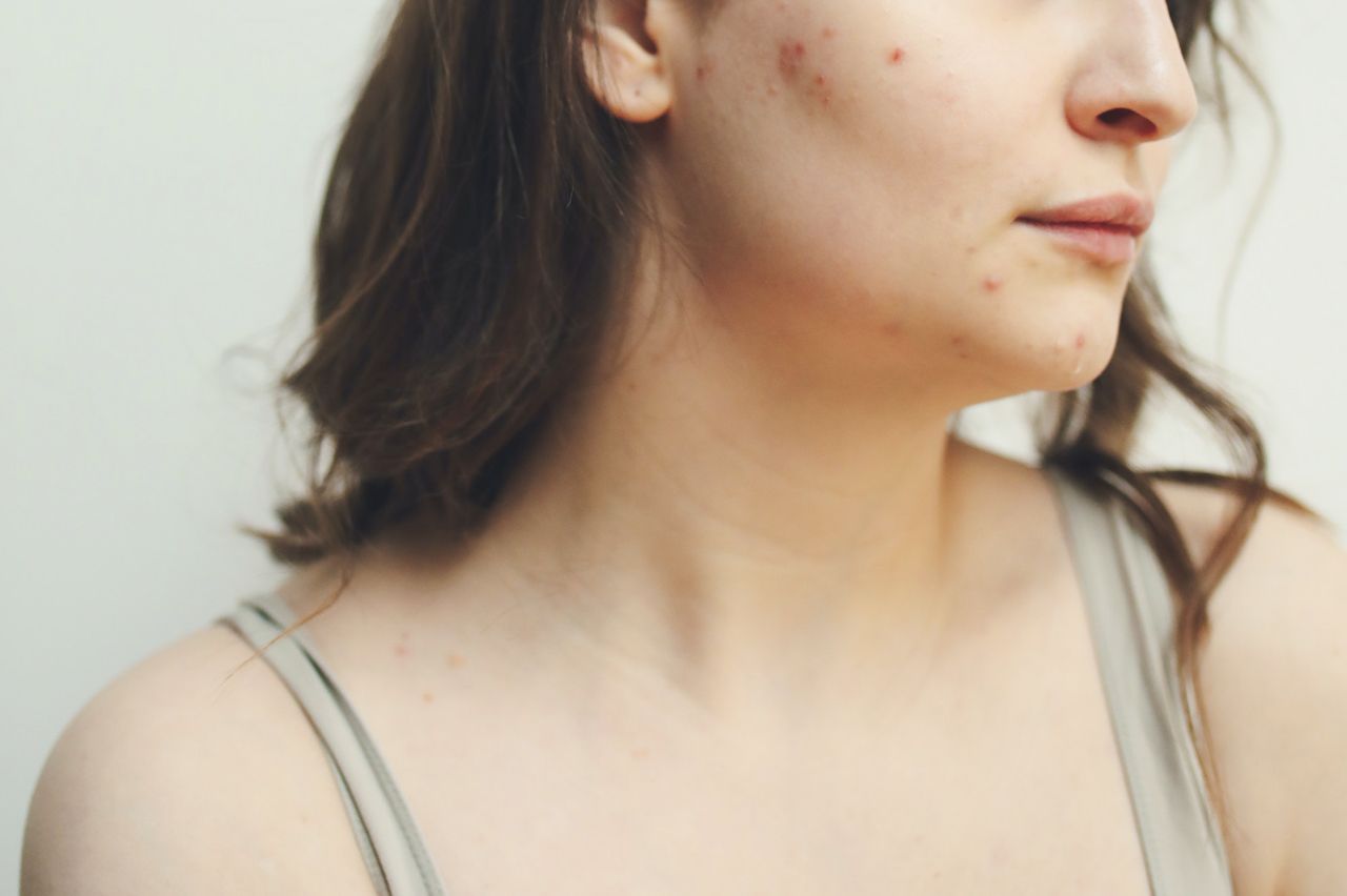 alergia-skorna-uczulenie-jak-leczyc