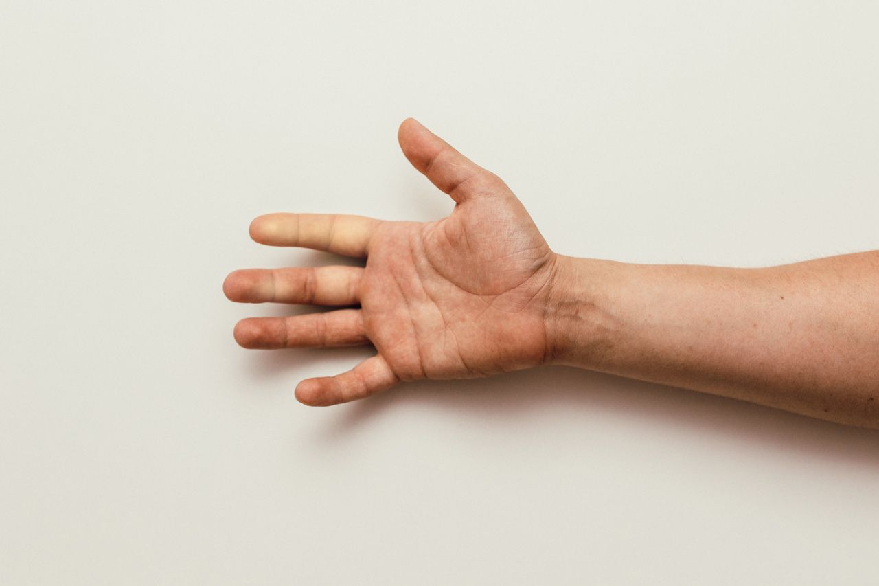 zespol-i-choroba-raynauda