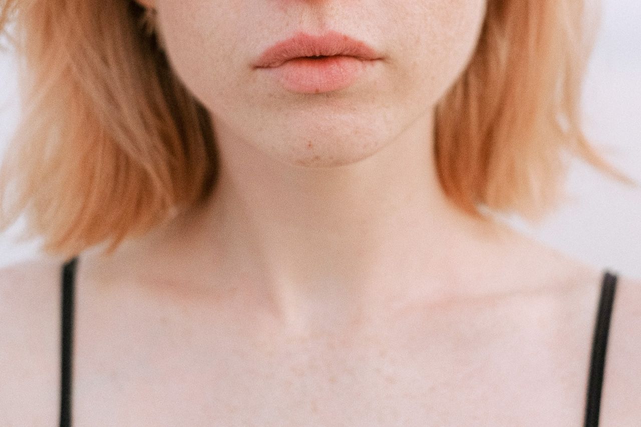 wole-guzkowe-nietoksyczne-tarczycy-objawy-leczenie